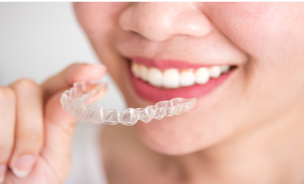 Teeth Straightening Charlotte - Adult Orthodontics - Invisalign